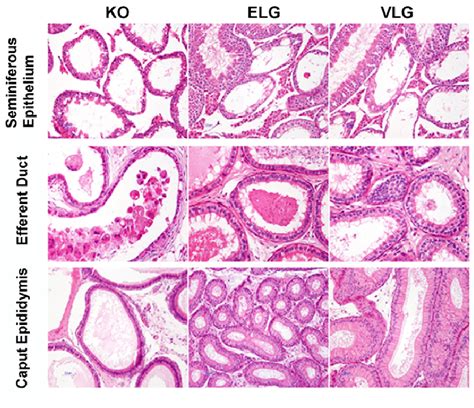 Histology Of The Seminiferous Epithelium Efferent Ducts And Epididymis