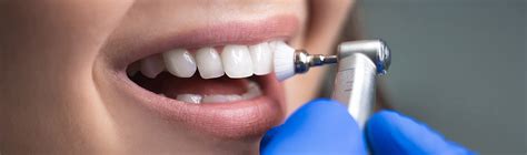 Dentist Teeth Cleaning Cost And Procedure Dentakay