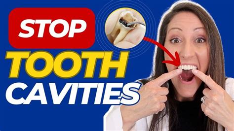 How To Prevent And Reverse Tooth Cavities And Dental Disease Free