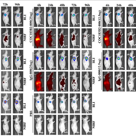 Immunohistochemical Ihc Staining Of Ovarian Cancer Tissues With