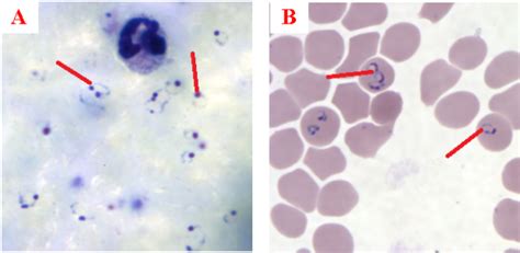 Terminologies Used In Plasmodium Infection Everything Microbiology