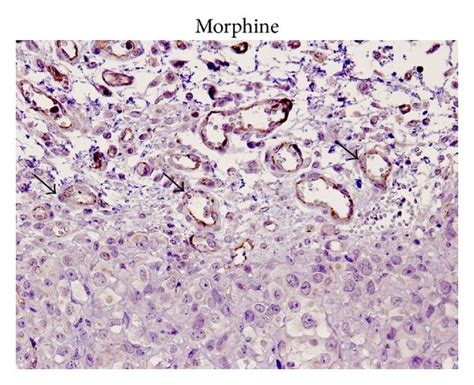 Morphine Promotes Angiogenesis Formation In Heterotopic Mouse Model Of