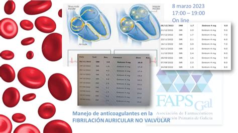 Qué es la FIBRILACION AURICULAR explicada para FARMACÉUTICOS Fapsgal