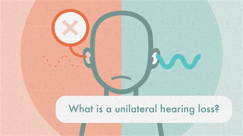 Unilateral Hearing Loss Youtube