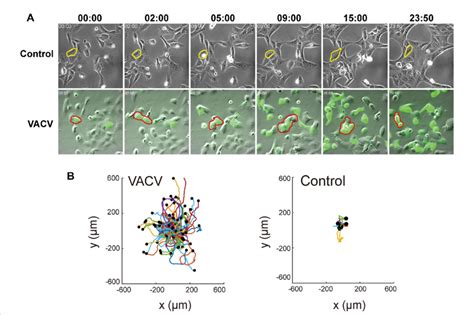 VACV Infection Induces Faster Vero Cell Migration A The Images At