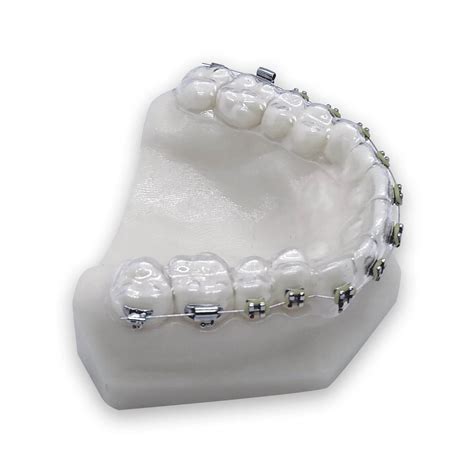 Fake Braces Buy Custom Made Removable Braces