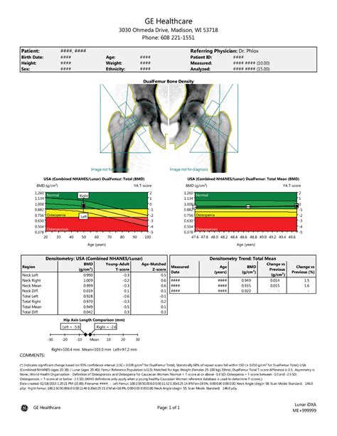 Ge Healthcare Bone Density Report Sample