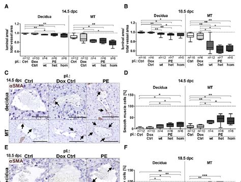 Sflt Soluble Fms Like Tyrosine Kinase Inhibits Vascular Smooth