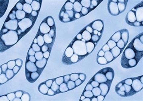 Ralstonia Eutropha Soil Bacteria With Big Potential Sysbiotech