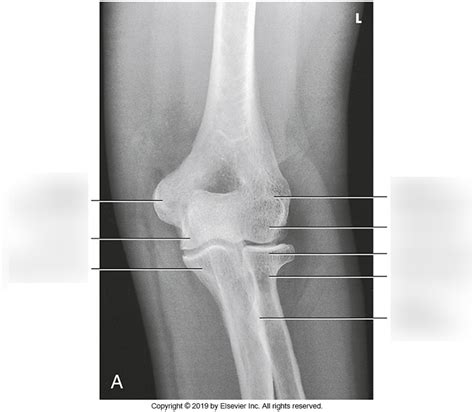 Left AP Elbow Diagram Quizlet