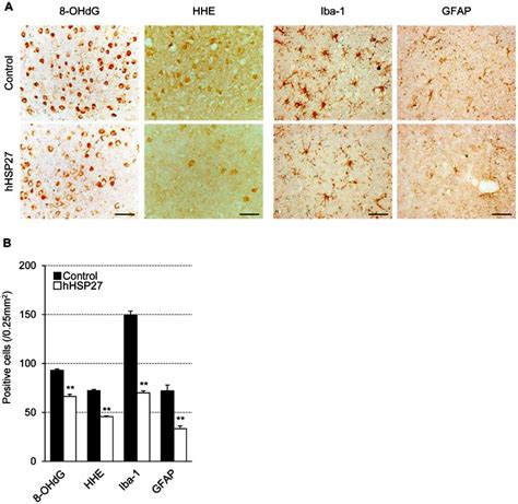 A Photomicrographs Of Ohdg Hhe Iba And Gfap Immunostaining