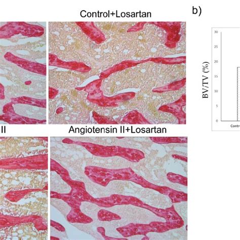 Effects Of Ang Ii And Losartan Administration On Bone Tissue A