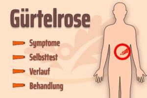 Gürtelrose Harmlos oder gefährlich