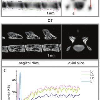 Maximum Intensity Projections Mips Of Focused Mouse Knee Joint Spect