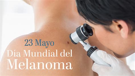 23 De Mayo Día Mundial Contra El Melanoma Residencia De Retiro Juan