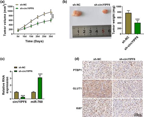 Circyipf Regulates Glioma Cell Proliferation Apoptosis And