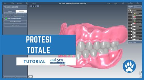 Protesi Totale Con Cad Lynx Evolution YouTube