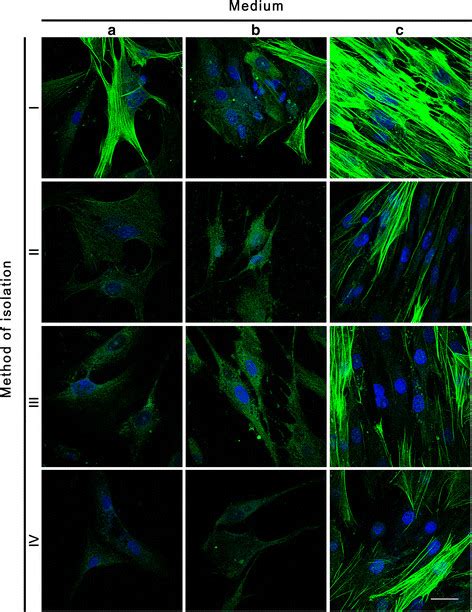 Expression Of α Smooth Muscle Actin In Primary Cultures Of Cells Download Scientific Diagram