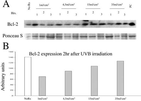 Ultraviolet B Radiation Induced Cell Death Critical Role Of