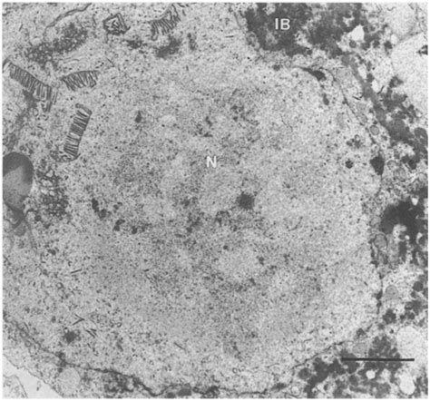 Electron Micrographs Of Thin Sections Prepared From Recombinant