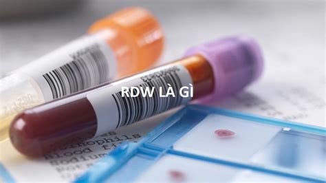 Rdw-sd trong máu là gì : Định nghĩa và vai trò của chỉ số RDW-SD