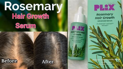 How I Stopped My Hair Fall Plix Hair Growth Serumbest Hair Hair Serum