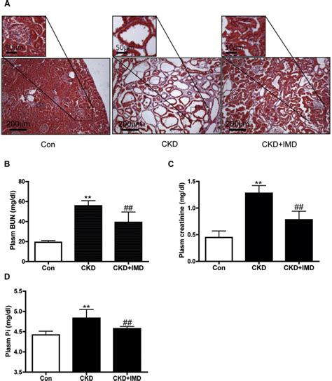 Intermedin153 Attenuates Vascular Calcification In Rats With Chronic