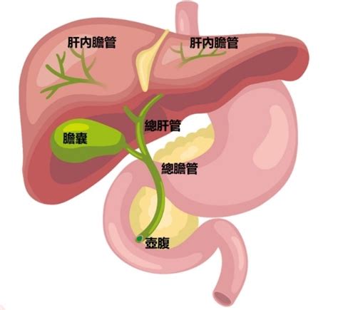 膽道癌是什麼？有哪4類型、還能活多久？症狀治療護膽飲食一次看uho優活健康網