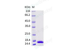 Recombinant Human IL 17A Protein 12047 HNAE Sino Biological