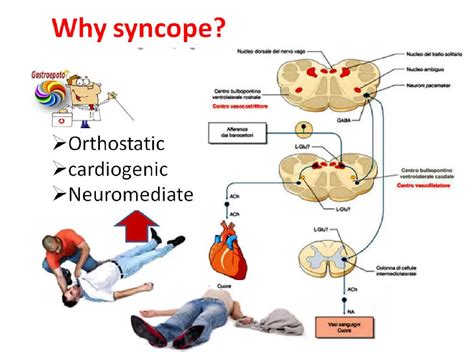 Vasovagal Syncope What Is It Causes Prevention And More Off