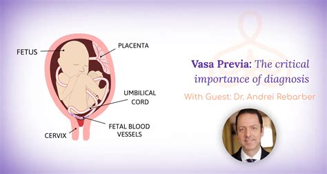 “vasa Previa The Critical Importance Of Diagnosis” With Dr Andrei