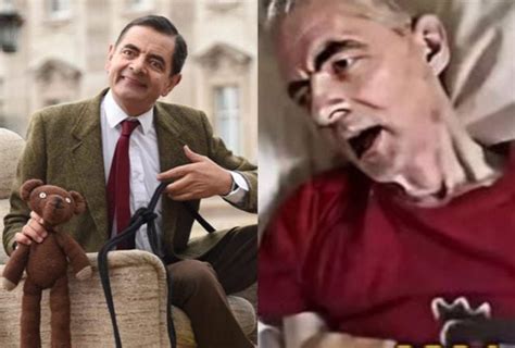 What To Know About The Viral Mr Bean On Death Bed Photo