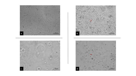 Proliferation Of Fibroblasts In D1 A Attachment Of Fibroblasts In D2