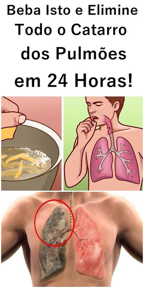 Beba Isto E Elimine Todo O Catarro Dos Pulm Es Em Horas Pulm Es