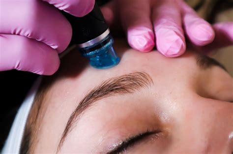 Hydrafacial à Fès Maroc Centre épilation Laser Fes