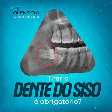 É Obrigatório Tirar O Dente Do Siso - Tirar o dente do siso é obrigatório – Olenscki Odontologia