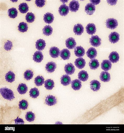 Vesicular stomatitis virus. Coloured transmission electron micrograph ...