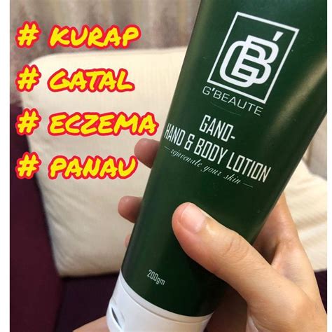 Ubat Kurap Gatal Panau Eczema Gno Exc€l💥 Shopee Malaysia