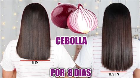 RETO 3 CEBOLLA PARA HACER CRECER EL CABELLO Y DETENER LA CAIDA EN 8