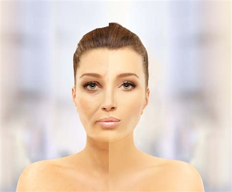 Best Laser Skin Rejuvenation National Laser Institute Medical Spa