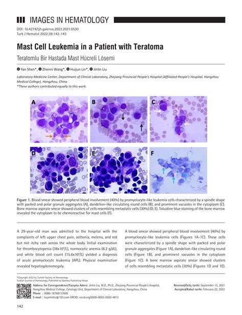 Pdf Mast Cell Leukemia In A Patient With Teratoma