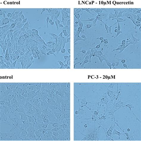 D Colony Formation Assay In Lncap And Pc Prostate Cancer Cells