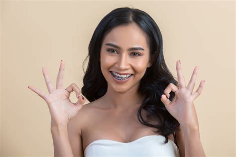 How Long Do Braces Take To Straighten Teeth