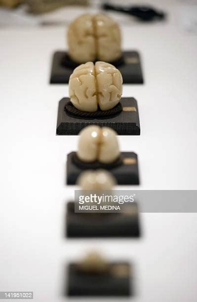 Human Stages Brain Photos And Premium High Res Pictures Getty Images