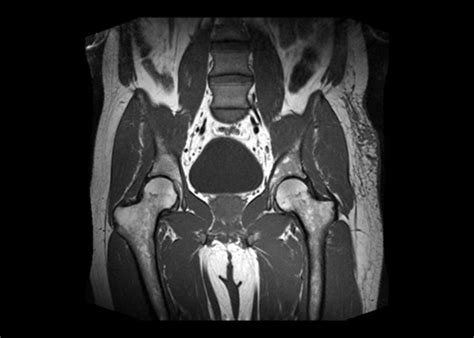 Mri Scan For The Pelvis Dubai Dr