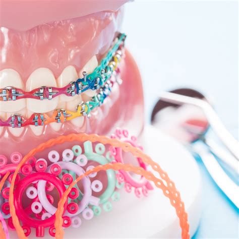 Qu Est Ce Que L Orthodontie Et Quels Sont Ses Avantages Centre