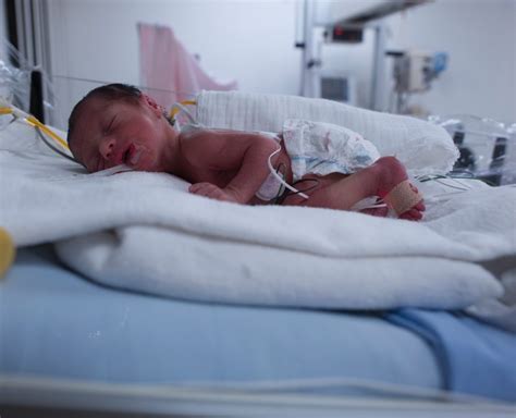 Inicio Hospital del Niño Dr José Renán Esquivel