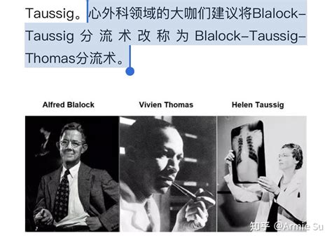 心脏手术先驱Vivien Thomas 与Dr Alfred Blalock 知乎