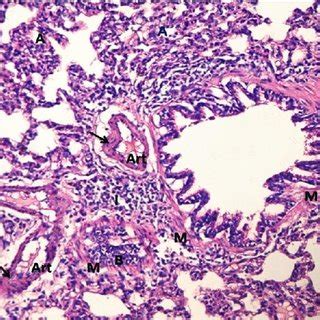 A Photomicrograph Of A Section In Rat Lung Of The Control Group Showing