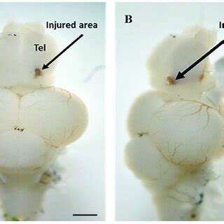 A Dorsal And B Lateral View Of An Adult Zebrafish Brain